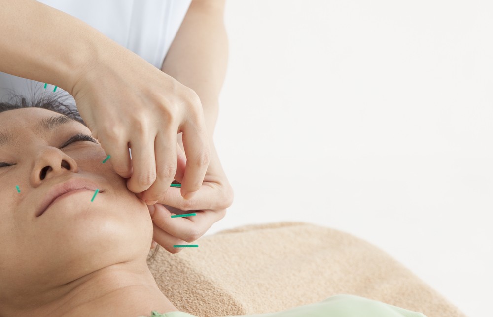 Facial acupuncture treatment